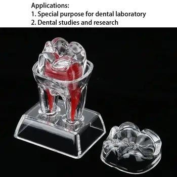 Odontologija Dantų Balinimas Dantų, Dantų Modelio Atskirti Plastiko Dantų Endodontinis Studentų Švietimo Priemonė, Odontologijos Įranga